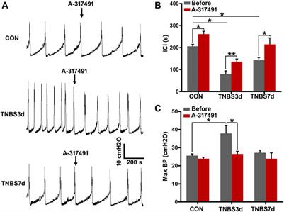 Upregulation of P2X3 receptors in primary afferent pathways involves in colon-to-bladder cross-sensitization in rats